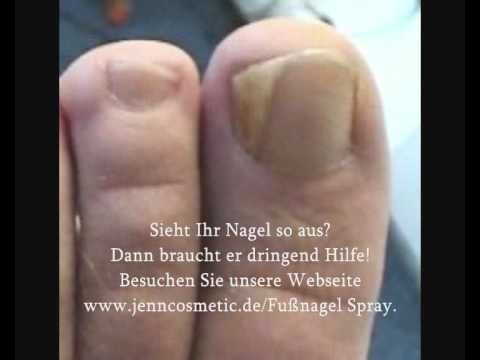 Man kann die Nägel getroffen gribkom anstreichen