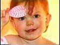 Hemangioma Forehead/TLC/Part 1