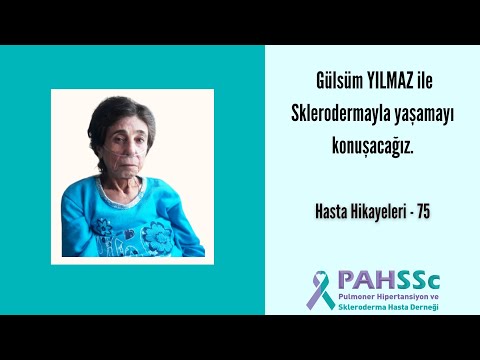 Hasta Hikayeleri - Gülsüm YILMAZ ile Sklerodermayla Yaşamak - 75 - 2023.05.16