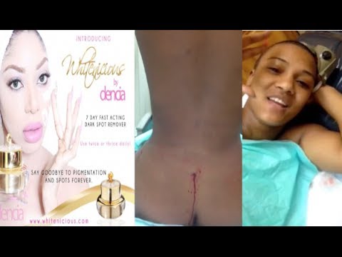 ass injections