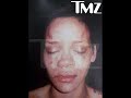 Rihanna Bloody and Bruised - Rihanna ft chris brown No Air (New Version) Rihanna Bloody and Bruised - Rihanna ft chris brown No Air (New Version)