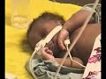 Pediatric Intensive Care Unit, Evangel Hospital Pediatric Care