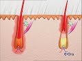 Dauerhafte IPL-Enthaarung mit E-One wirkt ab der 1. Anwendung