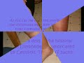 A bad case of Cellulitis - 7 days later Cellulitis