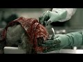 SAW 4