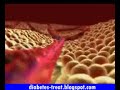 Insulin Benefit