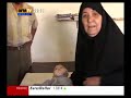 circoncision contre sida الختان