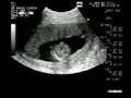 Fabiana alejandra mora teran 11-04-2007