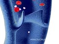 Animación Médica de 3D sobre DVT Embolism Pulmonar Animación Médica de 3D sobre DVT Embolism Pulmonar