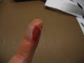 OUCH!!! I BURNED MY FINGERS WITH A HOT GLUE GUN!!