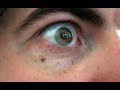 See Video