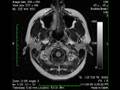 videos de Brain scan MRI
