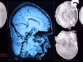 EL PODER DE LA MENTE, un cerebro superdotado - parte 6 de 6 -