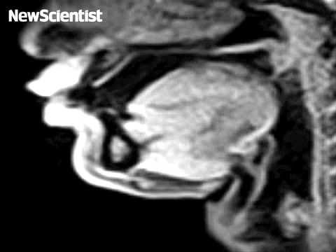 Real-Time MRI 