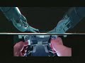 Podcast: Robotic-Assisted Hysterectomy for Endometrial...