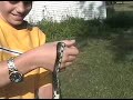Snake Bites My Kid