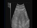Baby Mtz - Almaguer (7 semanas)