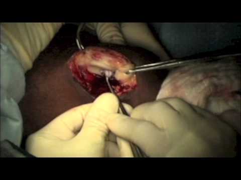 how to grow knee cartilage naturally
