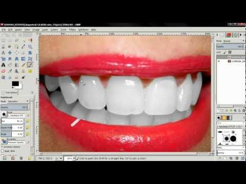 how to whiten teeth in a photo