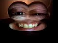 Tony Oursler, at Magasin 3 Tony Oursler, at Magasin 3