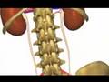 Kidney Stones: A Sign of Something Worse? (Dramatic Health)