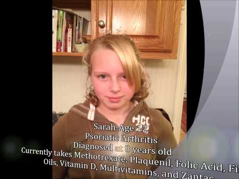 how to cure juvenile arthritis