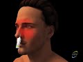 Best treatment for Sinusitis
