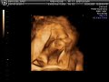 Baby Benoliel