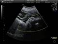 Baby Benoliel