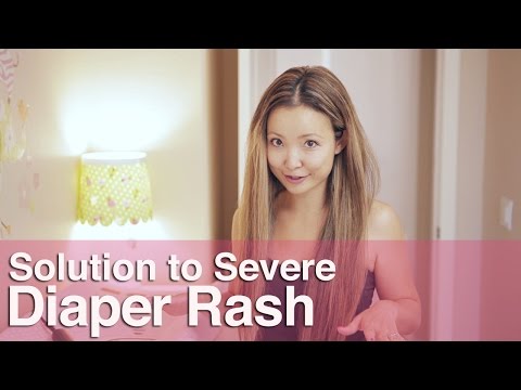 how to get rid diaper rash quick
