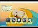 virtual surgery part 2