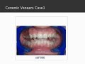 Dental Implant Cases Dental Implant Cases