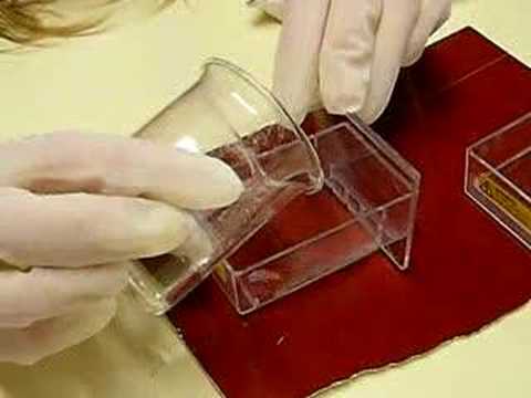 DNA Fingerprint - Colococação do gel ...