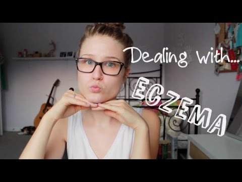 how to deal with eczema