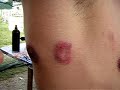 Paintball Wounds - 4 nipples