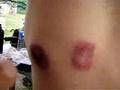 Paintball Wounds - 4 nipples