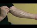 Cut made with Gel-10