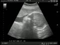 Nuestro bebe 31 y 33 semanas