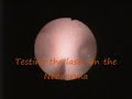 Nefroscopy and stone removal