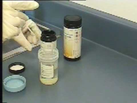 how to assess urine concentration