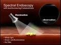Prize Winning Video Autofluorescent Endoscopy
