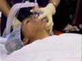 Addicted to Plastic Surgery? Feat. Dr. Hicks, Beverly Hills