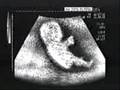 Baby in the womb driving