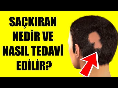 Saç Kıran Neden Olur? - Saç Kıran Nasıl Geçer? - Canım Anne
