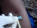 Drawing blood