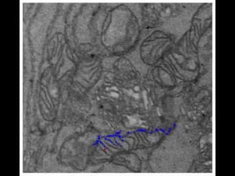 Unsupervised segmentation of mitochondria using model-based spectral clustering