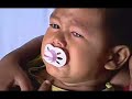 Obesidade infantil
