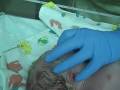 Video 1