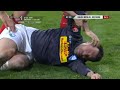 Matias Concha - Beinbruch nach Horror-Foul (1. FC Union Berlin vs VfL Bochum 1848 eV)