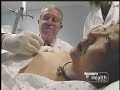 See Video